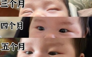 新生儿几个月会变成双眼皮？是自然变化还是与后天因素有关？