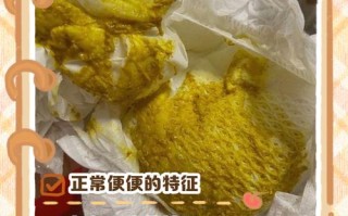 新生儿频繁排便是否正常？需要关注哪些信号？