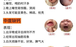 新生儿缺钙有哪些具体表现？家长该如何科学判断与应对？