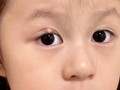 新生儿眼缝长眼睛却小