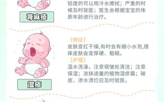 新生儿金葡菌感染究竟源于哪些常见途径？母婴传播、环境接触还是护理疏漏？