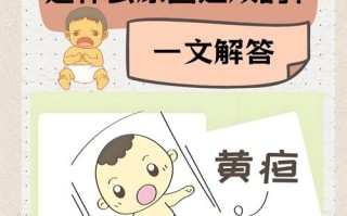 新生儿黄疸360μmol/L算严重吗？需要立即治疗吗？