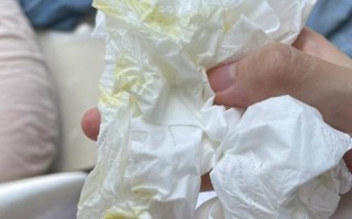 新生儿吐黄水是正常现象还是疾病信号？需要警惕哪些原因？