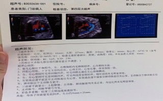 新生儿三尖瓣重度返流能自愈吗？需立即手术吗？对发育有何影响？