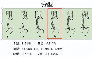 新生儿食道闭锁手术费用差异大，医保能报销多少？家庭该如何承担？