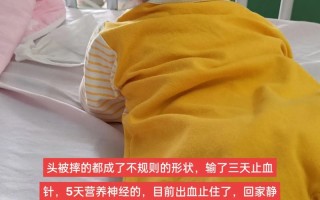 新生儿颅内出血的临床表现有哪些具体特征及早期识别要点？