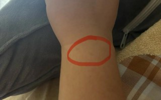 孕期手腕手指关节疼是缺钙还是激素变化？该怎么缓解才安全？