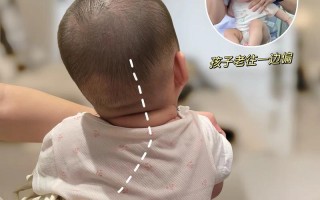 新生儿睡觉总偏向一侧，是正常习惯还是需要警惕的健康信号？