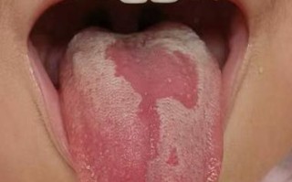 刚出生新生儿舌头发紫是正常现象还是缺氧信号？需要立即就医吗？