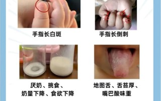 儿童缺锌会有哪些典型症状？家长该如何辨别和应对？