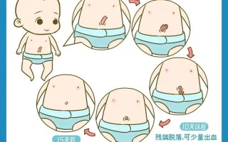 新生儿脐带护理不当会感染吗？日常清洁与干燥要注意哪些细节？