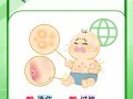 儿童身上起水泡是怎么回事