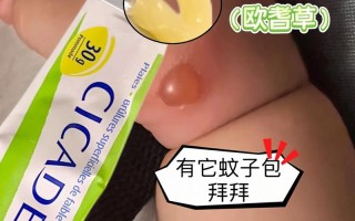 新生儿湿疹能用薄荷水治疗吗？这种偏方是否安全有效？