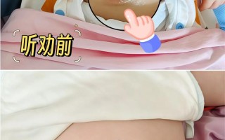 新生儿肚脐渗血一般持续多久？需要特殊处理吗？