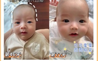 新生儿头大身子小正常吗？图片中的发育情况需要关注吗？