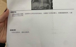 儿童双肺纹理增重模糊是肺炎吗？需要做哪些检查？