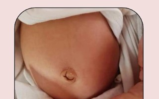 新生儿脐带发炎时宝宝会疼吗？家长该如何观察和处理？