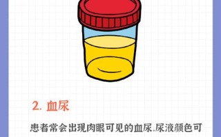 儿童尿结石的诱因有哪些？日常饮食与生活习惯如何影响结石形成？