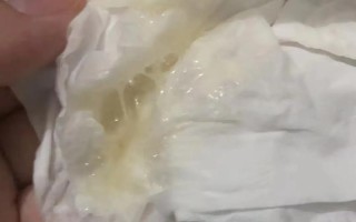 新生儿20天喉咙有痰咳不出怎么办？需要担心什么问题吗？