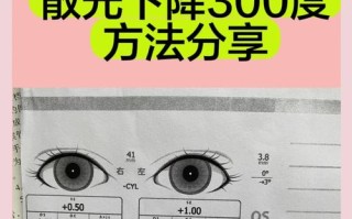 儿童散光多少度算严重？不同年龄段标准有何差异？