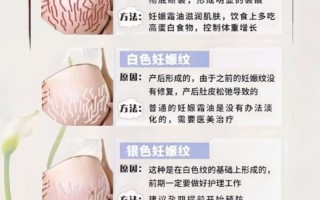 孕期长妊娠纹真的能抑制吗？有没有科学方法能减少或避免妊娠纹的出现？