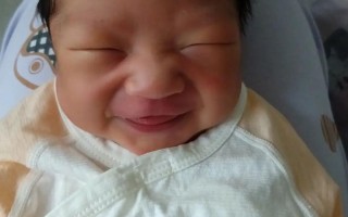 新生儿黄疸在家怎么测？这些方法和注意事项家长必须知道！