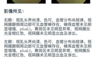 新生儿眼底检查费用受哪些因素影响，大概需要多少钱？