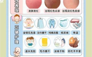 新生儿热疹什么时候消