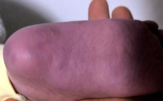 新生儿洗完澡后手脚发紫是正常现象还是健康警报？