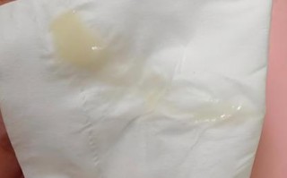 孕期白带有异味是正常现象吗？需要警惕哪些潜在问题？