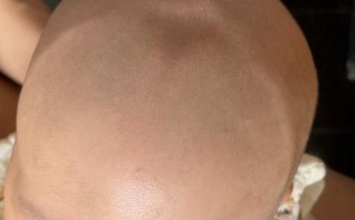 新生儿后囟门具体位于头部哪个位置？何时闭合才正常？