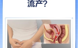 怀孕期间哪些行为或因素容易引发流产风险？