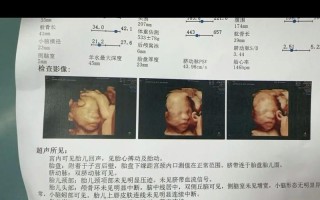 孕期三维检查具体包含哪些项目？能排查哪些胎儿畸形问题？