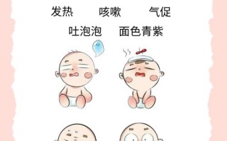 新生儿急性上呼吸道感染有哪些典型症状与护理要点？