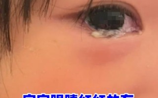 儿童眼睛红有眼屎是结膜炎吗？这些图片能帮你判断吗？