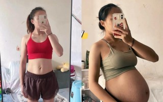 孕期肚子左右不对称正常吗？是否需要担心胎儿发育问题？