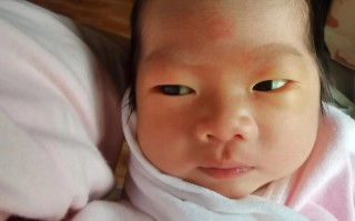 新生儿眼睛眼白发黄是正常现象还是健康预警？需警惕哪些潜在问题？