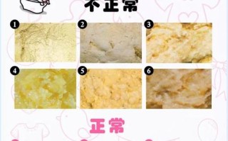 新生儿每天排便次数多少算正常？不同喂养方式下排便差异大吗？