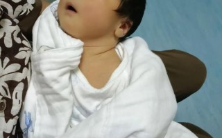 新生儿第六天黄疸16mg/dl需要立即干预吗？对宝宝有影响吗？