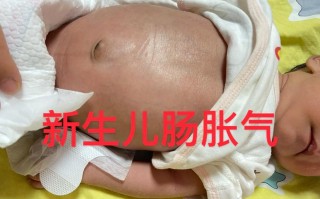 新生儿20天涨7两是正常发育速度吗？需要关注喂养方式吗？