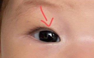 新生儿出生时单眼皮，之后会自然变成双眼皮吗？这背后有什么科学依据？