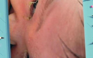 新生儿眼睛有黄色眼屎是正常现象还是感染信号？需要处理吗？