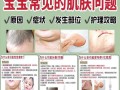 新生儿头顶湿疹反反复复，到底该如何护理才能有效缓解？