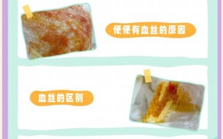 新生儿血液细菌感染严重吗？早期治疗能治愈吗？对宝宝未来健康有影响吗？