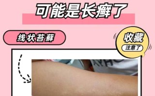 儿童皮肤真菌感染图片有哪些典型症状及如何正确识别与处理？