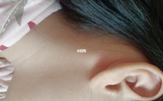 儿童耳后淋巴结肿大图片显示异常，是否需要立即就医排查病因？