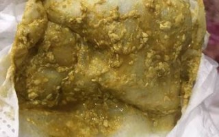 新生儿混合喂养大便有奶瓣怎么办？