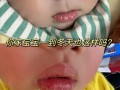 新生儿下嘴唇老颤抖是怎么回事