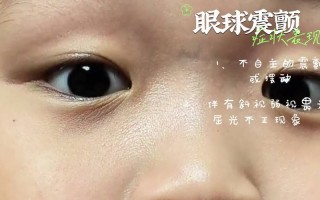 新生儿眼睛震颤是正常生理现象还是异常信号？需警惕哪些潜在病因？