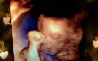 备孕期间照B超安全吗？对胎儿发育有影响吗？